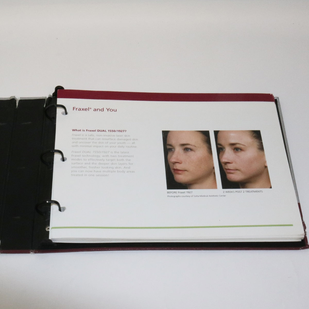 2011 Fraxel Dual 1550/1927 Before & After Waiting Room Photobook MK1191C