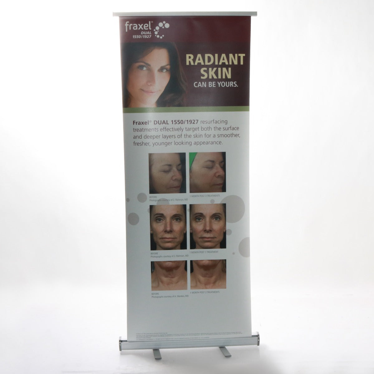 Fraxel Dual 1550/1927 Laser Skin Resurfacing Marketing Retractable Banner 33x80