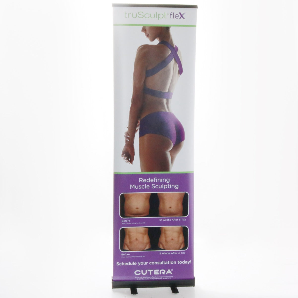 2019 Cutera truSculpt Flex 24x80" Before & After Retractable Marketing Banner