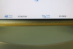 Palomar StarLux 300 IPL Star Lux ACNE Configured Lux V Redness Pigmented Lesions