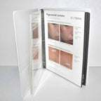 Cutera Xeo Laser Before After Office Photo Patient Treatment Book Consult Guide