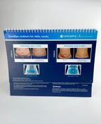 Coolsculpting, “Goodbye, stubborn fat. Hello, results” Brochure