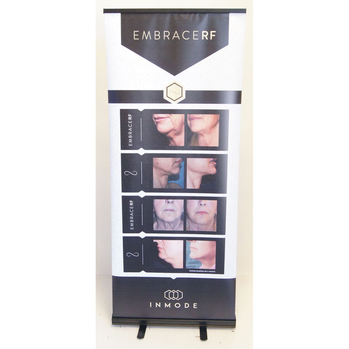 InMode EmbraceRF Skin Tightening RF Chin Neck Vinyl Office 35in x 85in Banner