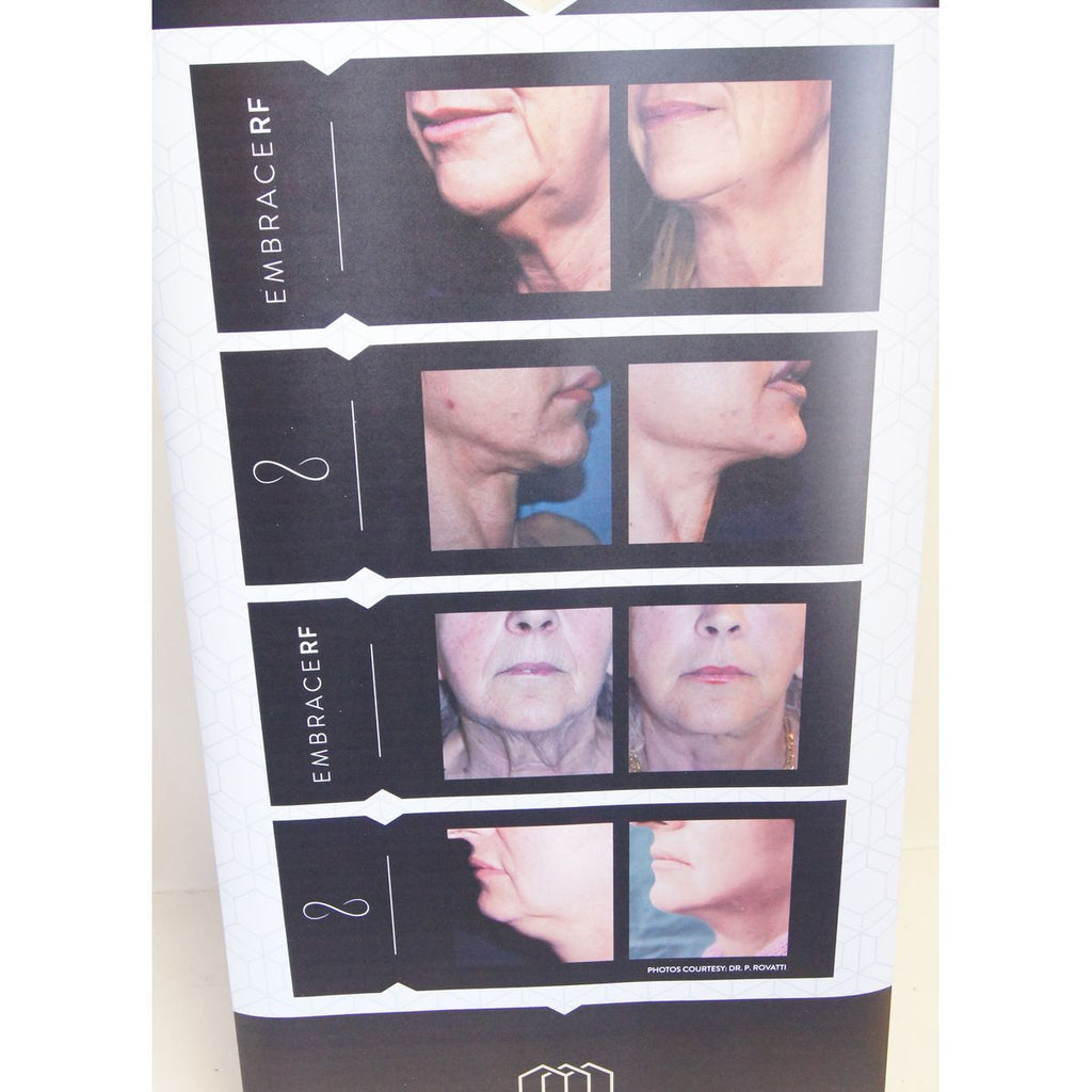 InMode EmbraceRF Skin Tightening RF Chin Neck Vinyl Office 35in x 85in Banner