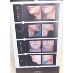 InMode EmbraceRF Skin Tightening RF Chin Neck Vinyl Office 35in x 85in Banner