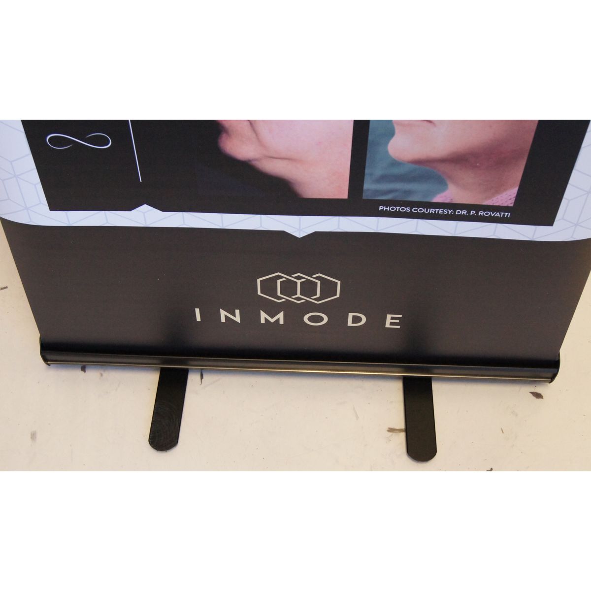 InMode EmbraceRF Skin Tightening RF Chin Neck Vinyl Office 35in x 85in Banner