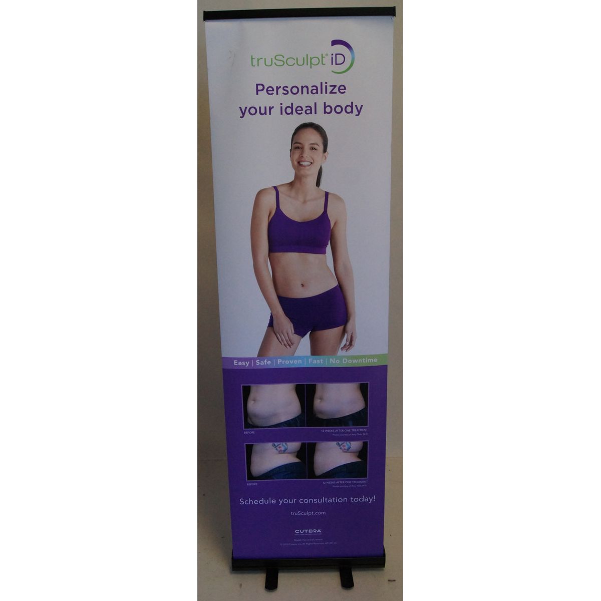 Cutera truSculpt iD Before & After 25in x 83in Retractable Marketing Banner