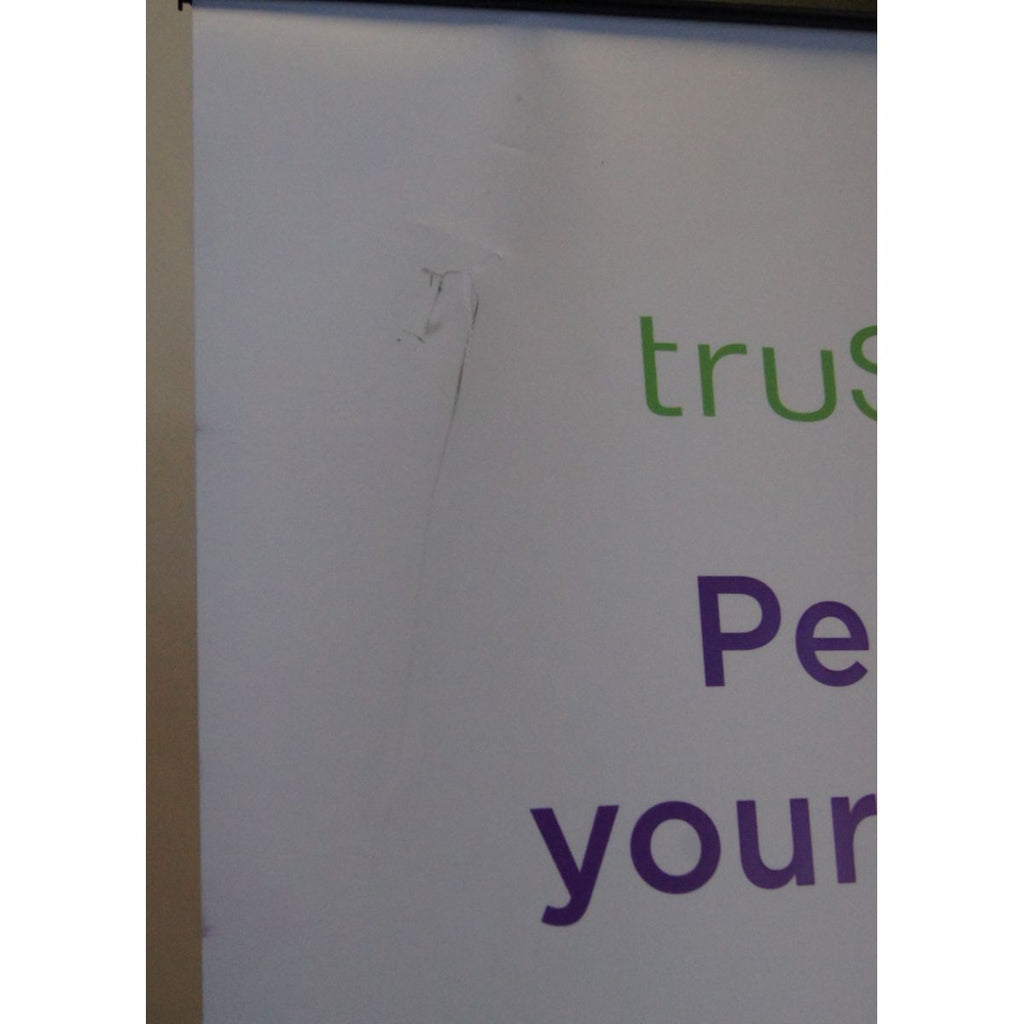 Cutera truSculpt iD Before & After 25in x 83in Retractable Marketing Banner