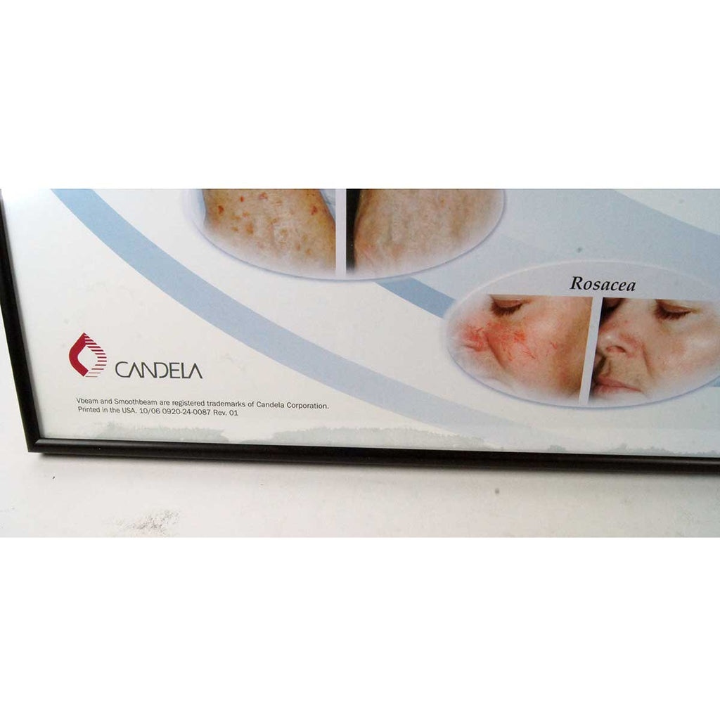 Candela Vbeam Better Skin Office Marketing Wall Frame 28.25in x 22.25in