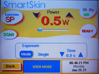2011 Cynosure 30W Affirm CO2 Ablative Wrinkle Laser Skin Rejuvenation Tightening