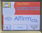 Cynosure 30 Watt Affirm CO2 Ablative Wrinkle Laser Incisional Fractional C02