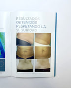 BTL AESTHETICS, EXILIS ELITE ADVERTSING