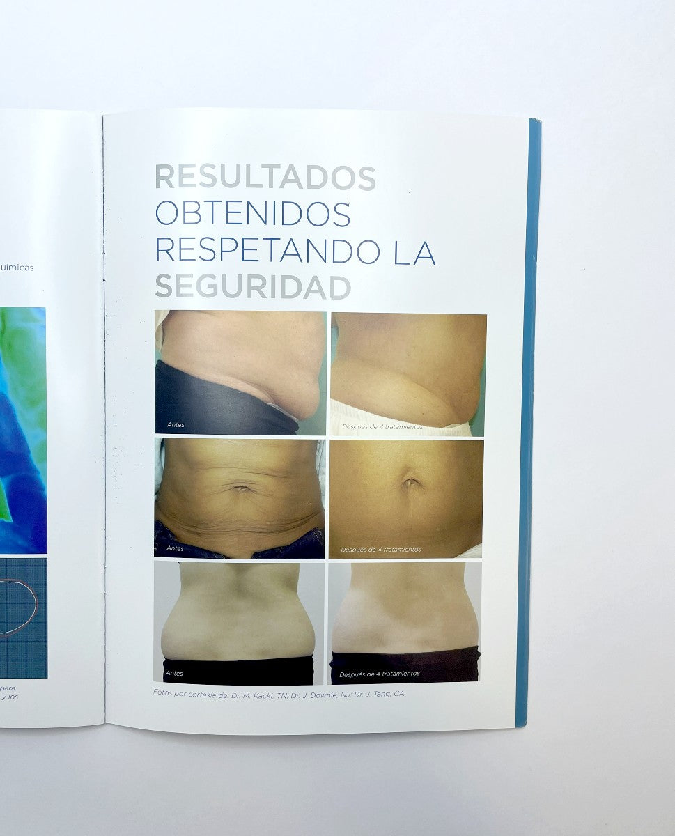 BTL AESTHETICS, EXILIS ELITE ADVERTSING
