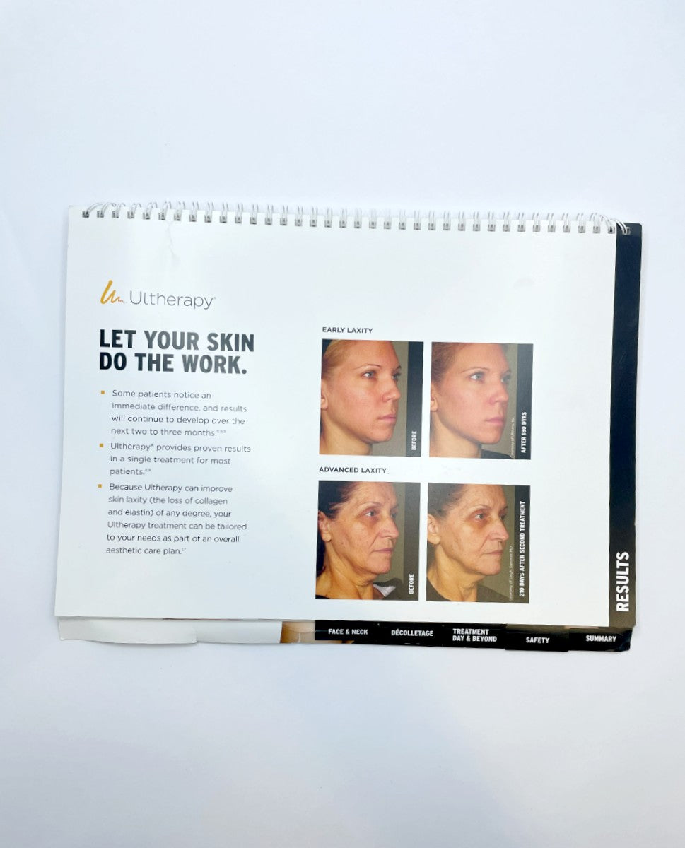 Ultherapy Face & neck, Face treatment guide