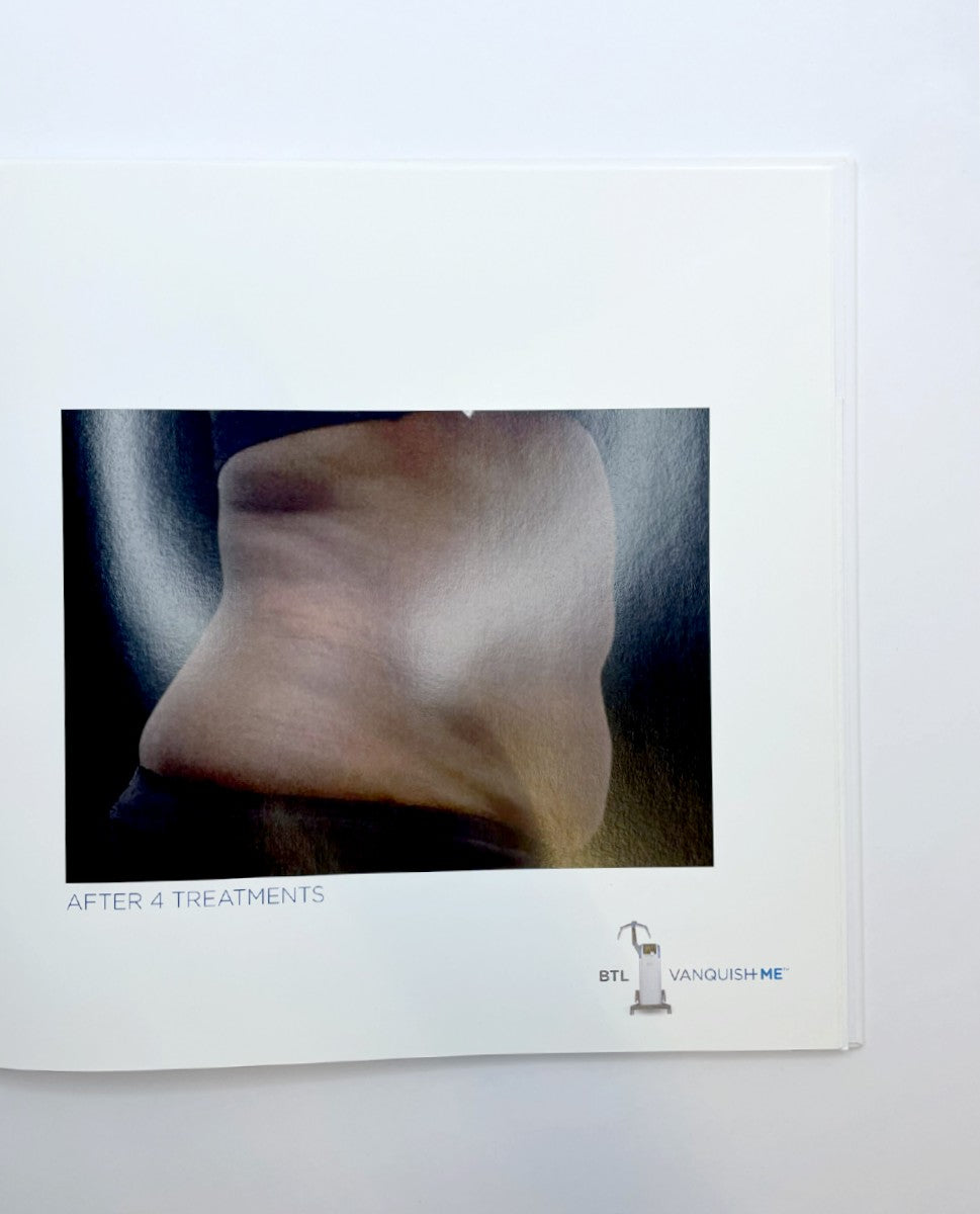 BTL AESTHETICS VANQUISH ME RESULTS ALBUM PN 713-74VQMEABOOKKENU5300