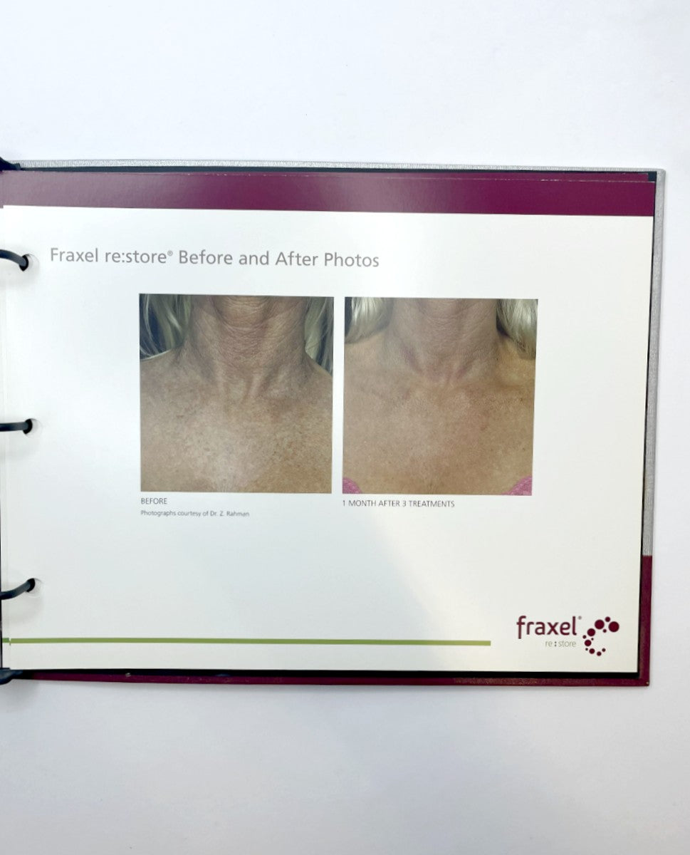 Fralex Treatment Reference Guide