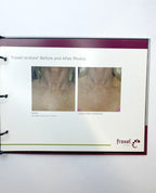 Fralex Treatment Reference Guide