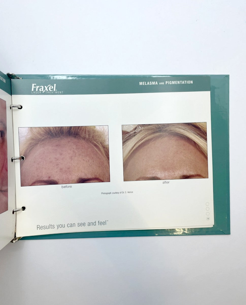 RELIANT Fraxel Laser Treatment Patient Photo Book