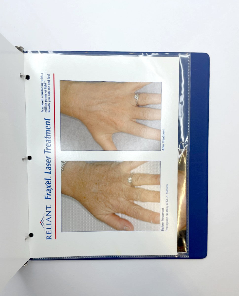 RELIANT Technologies, Inc. Fraxel Laser Treatment Fractional Resurfacing with a Million Points of Light 10-02233 Rev 1 EXP 2005