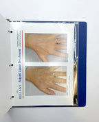 RELIANT Technologies, Inc. Fraxel Laser Treatment Fractional Resurfacing with a Million Points of Light 10-02233 Rev 1 EXP 2005