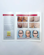 LUTRONIC INFINIskin BROCHURE
