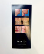 INMODE FACEtite, MINIMALLY INVASIVE FACIAL CONTOURING, IN JIS ONE TREATMENT 47/pk