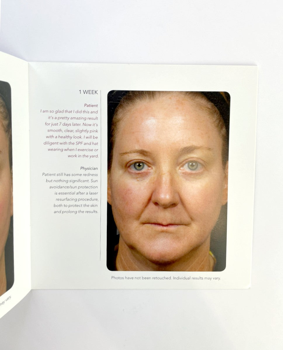 FRAXEL SOLTA MEDICAL BROCHURE PATIENT DIARY 27/pk