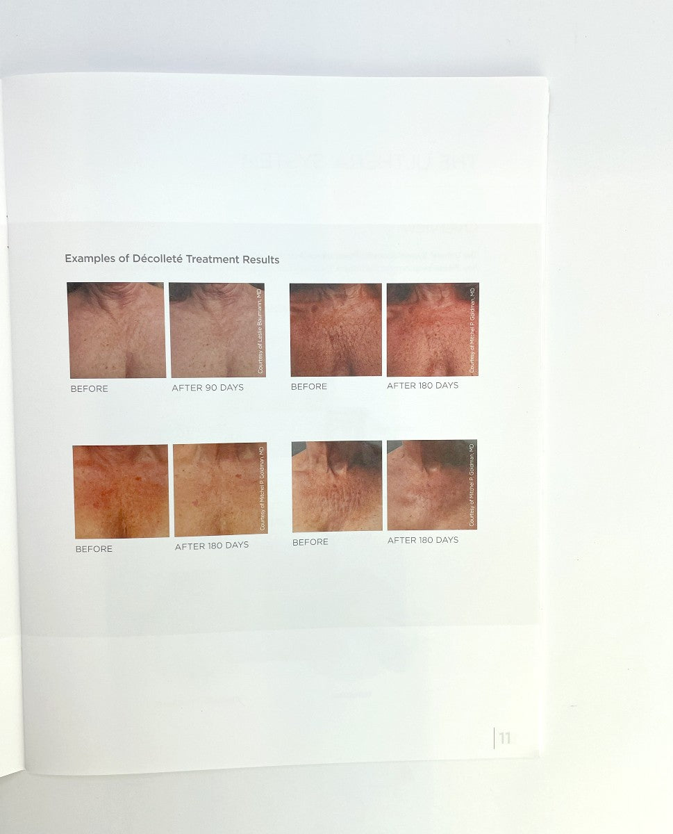 MERZ AESTHETICS Ultherapy Customer Training Manual 100583SE EXP 2019