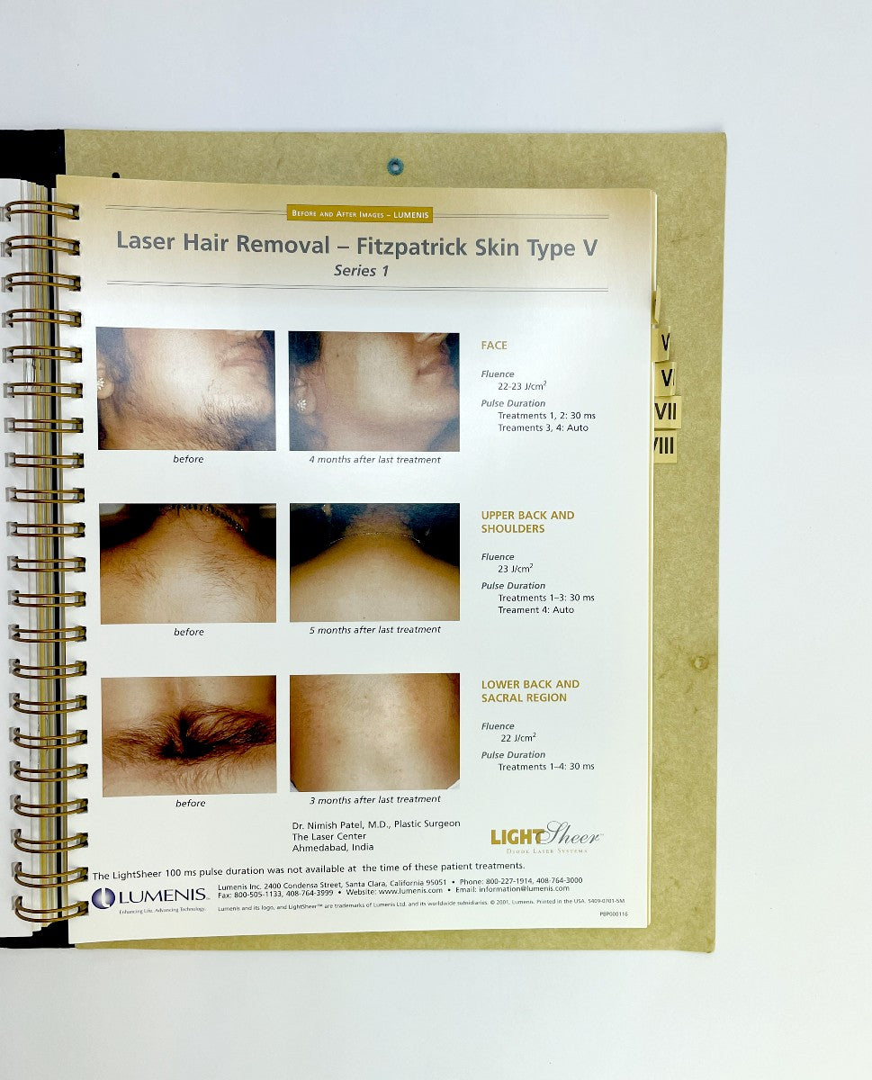 LUMENIS Laser Hair Removal Manual PB 000 0074 Rev. A EXP 2000