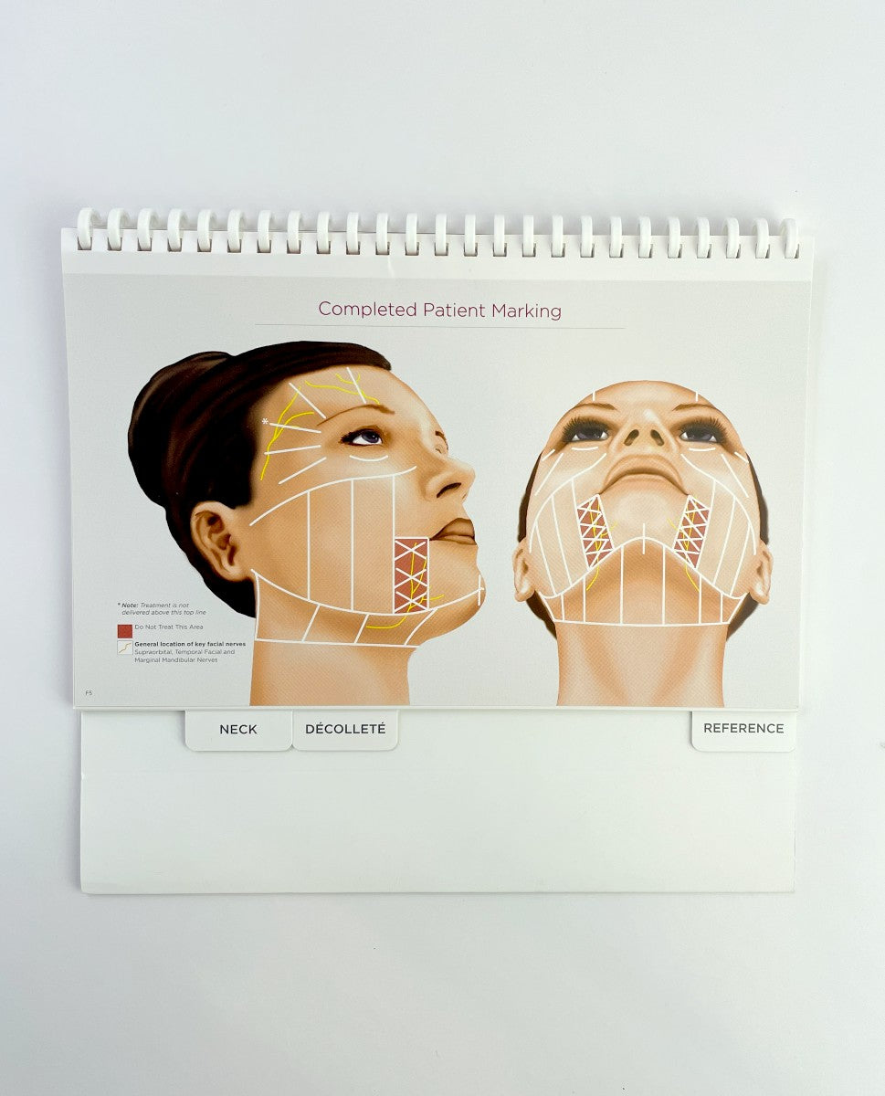 Ulthera Ultherapy Treatment Reference Guidelines Handbook 1003028E