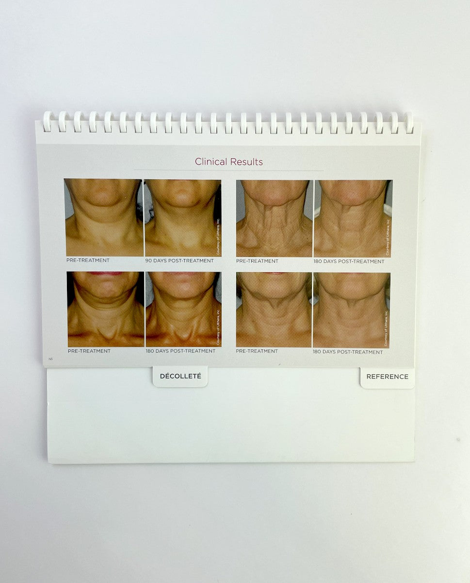 Ulthera Ultherapy Treatment Reference Guidelines Handbook 1003028E
