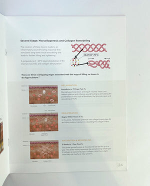 Merz Ultherapy Customer Training Guide Manual Book 1005835
