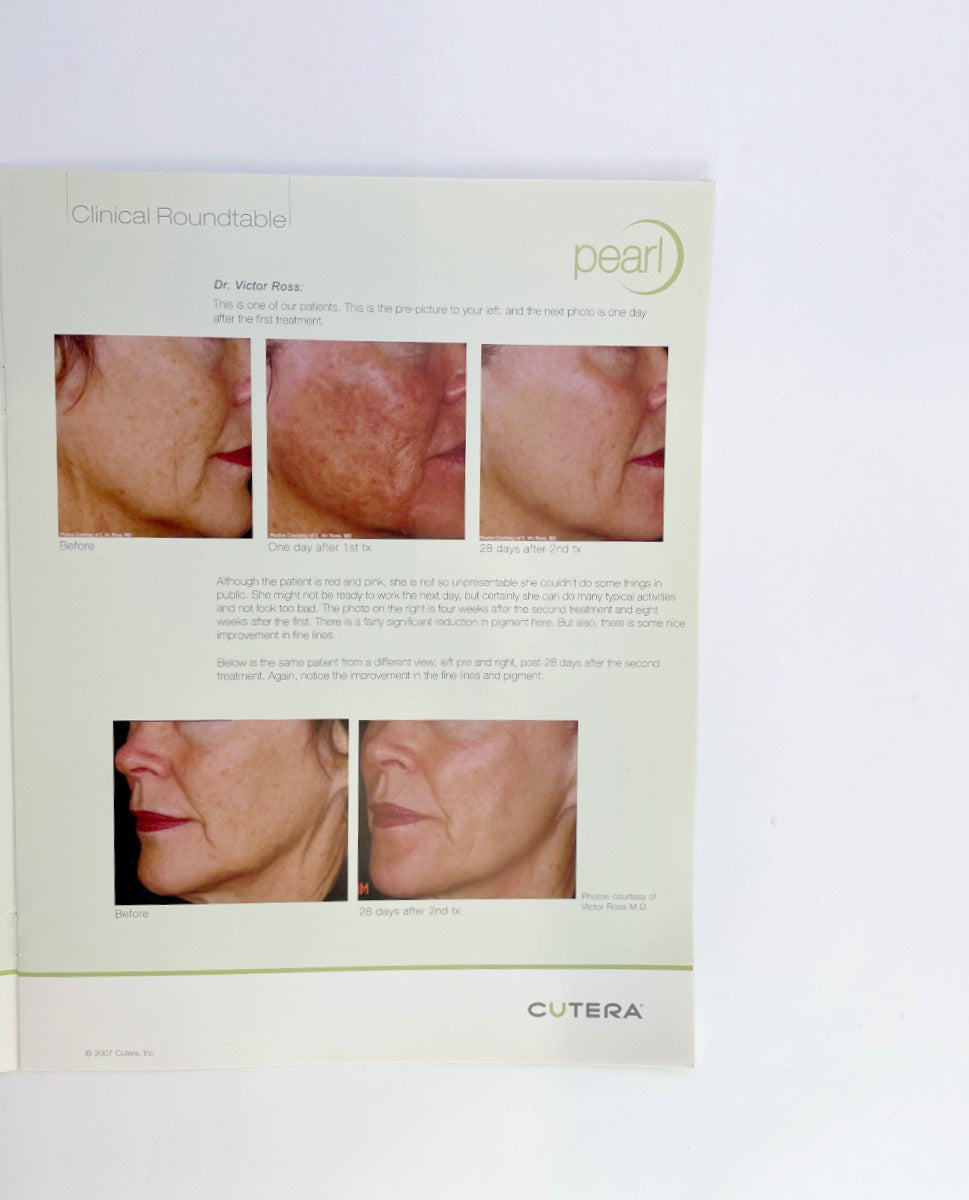CUTERA, PEARL TM, CLINICAL ROUNDTABLE BROCHURE 2007