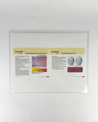 RELIANT Fraxel, Customer Service 1-888-4FRAXEL (437-2935), 650-605-2202, 2004-2007, SR1500 Laser Quick Start Guide