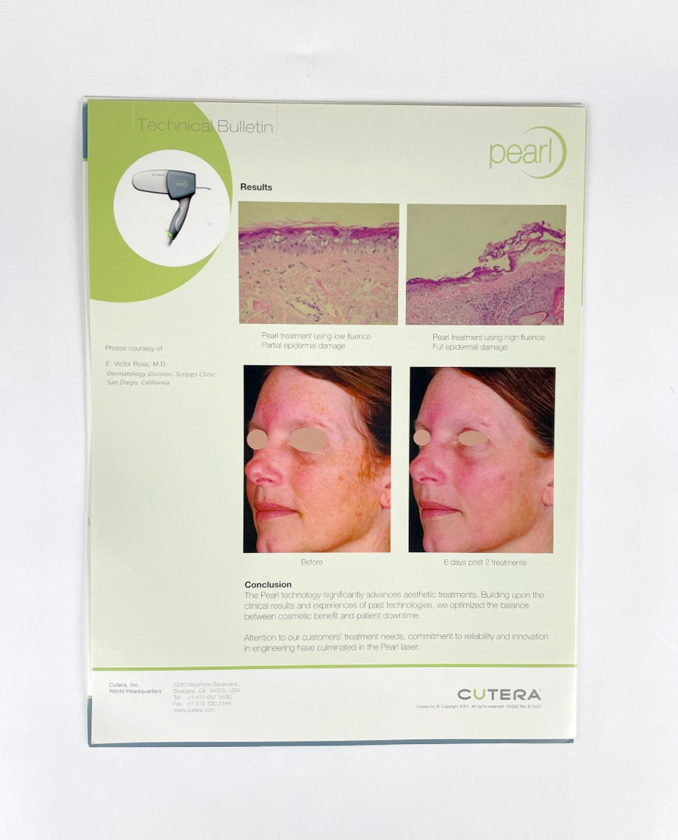 CUTERA, PEARL WITH YSGG TECHNOLOGY, TECHNICAL BULLETIN, D0539 Rev. B 0307, 2007