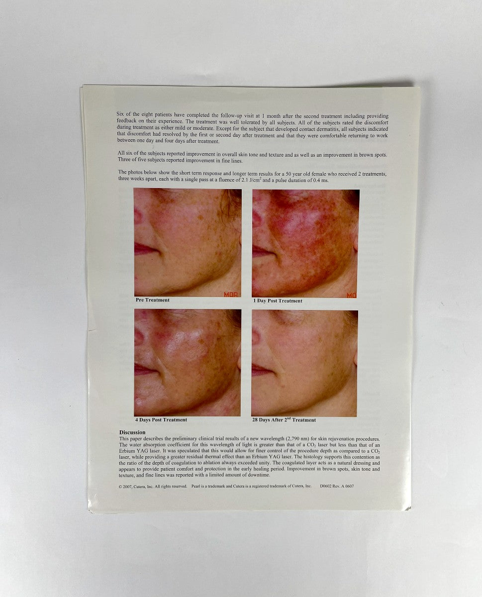 Cutera Brochure High-Fluence Treatments with a 2,790 nm YS