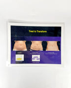 Treatment to transform with coolsculpting, Washington Institute of Dermatologic Laser Surgery Presentation