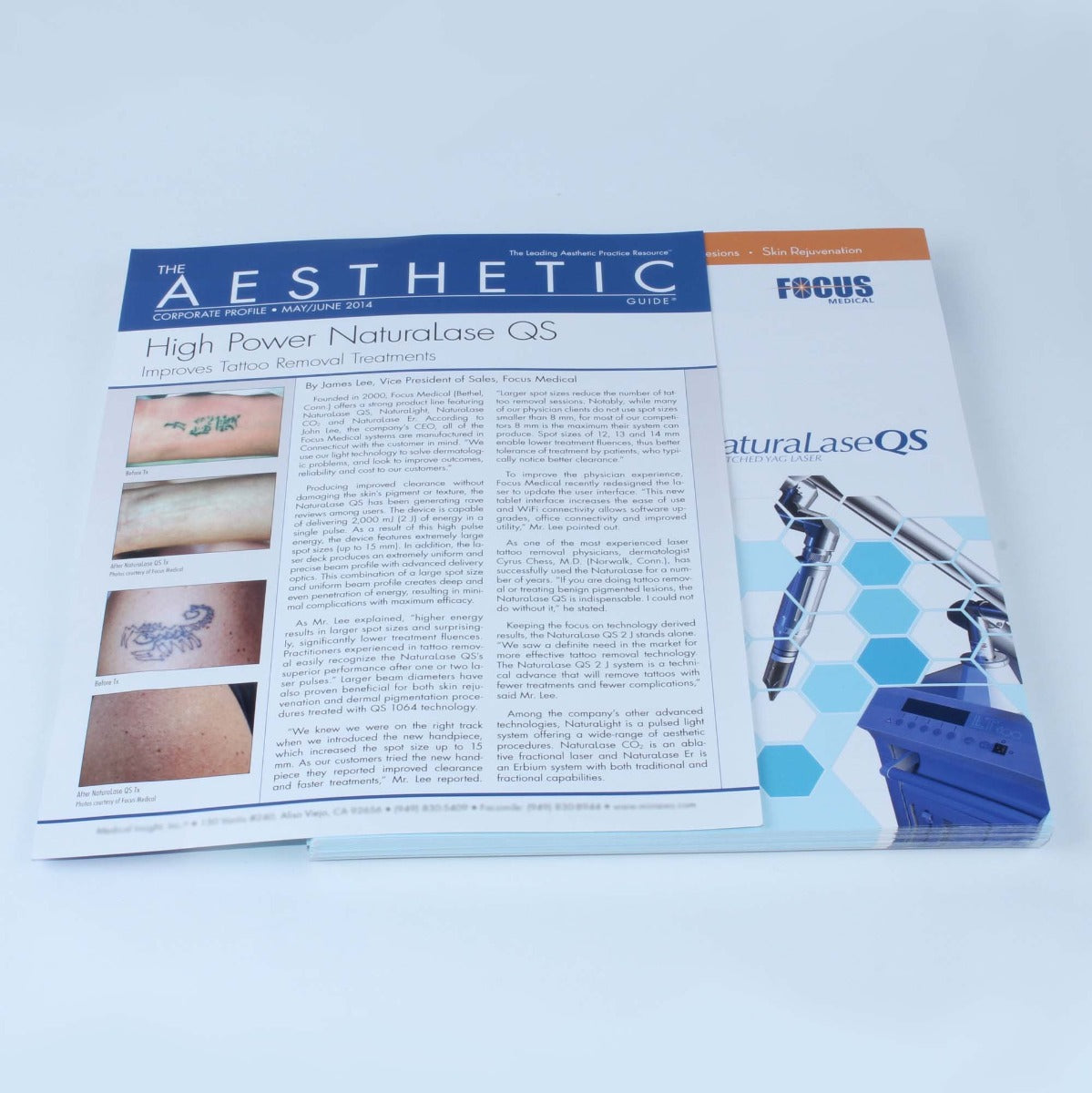 2014 Focus NaturaLaseQS Tattoo Removal Laser Clinical Article White Paper(113ct)