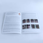 Asclepion MCL31 Dermablate ErYAG 2940 Laser Acne Treatment Case Report Brochures