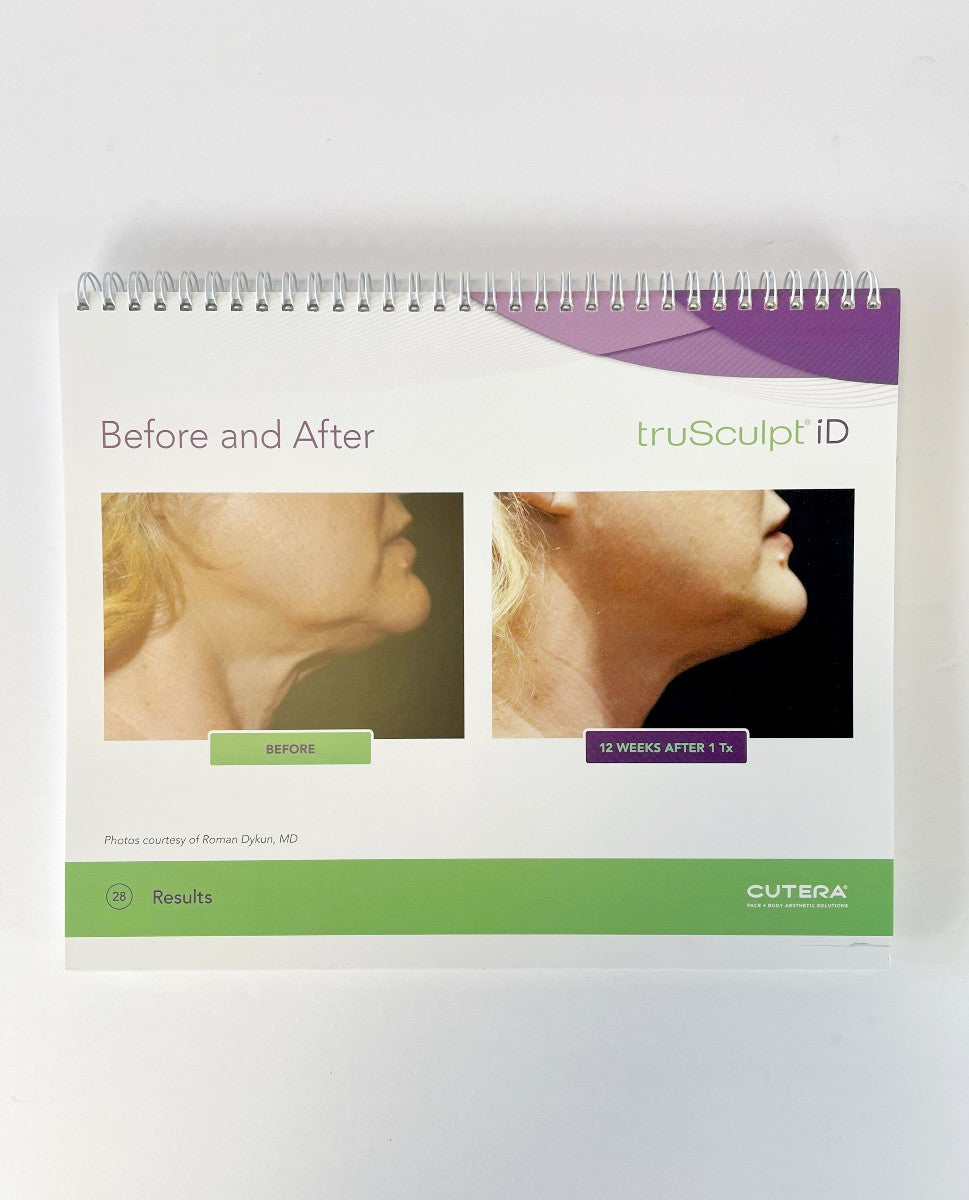 CUTERA truSculpt iD, CONSULTATION GUIDE