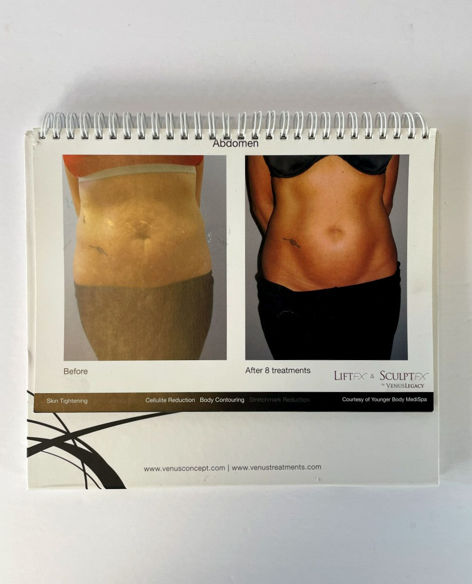 VENUS CONCEPT, The LiftFX & SculptFX Experience, Presentation book