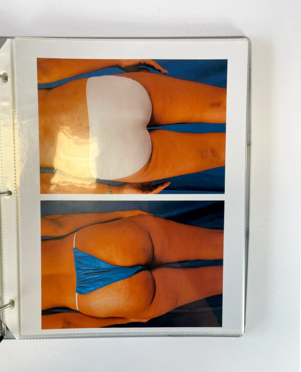 BareMedix Photo Gallery Book Before and After
