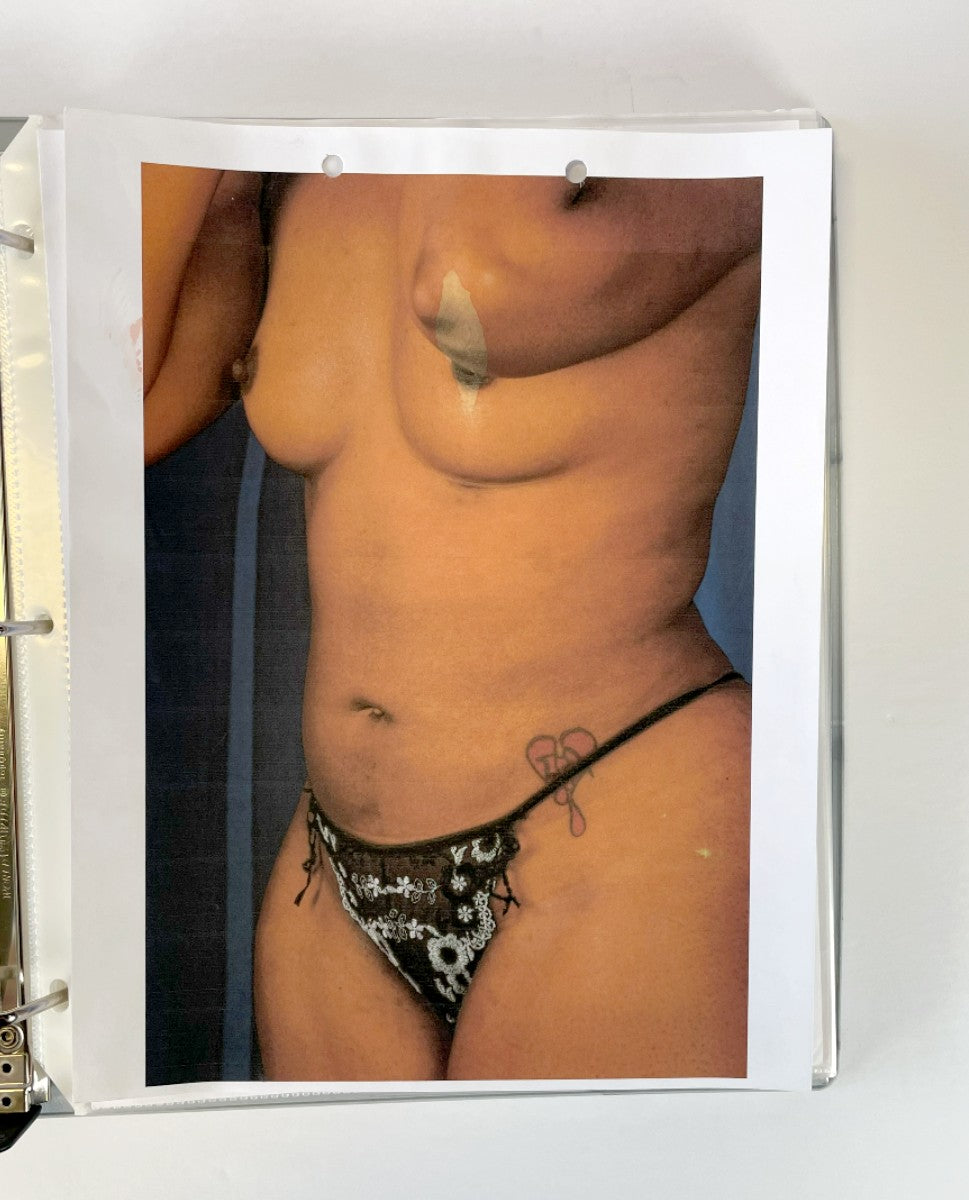 BareMedix Photo Gallery Book Before and After