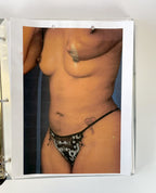 BareMedix Photo Gallery Book Before and After