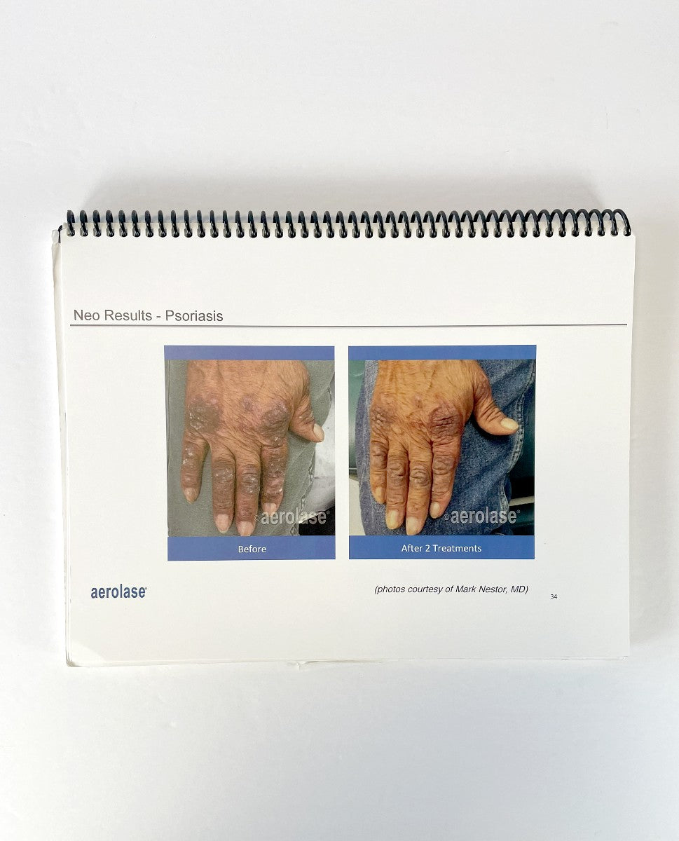Neo Fundation Therapy Safe, Effective & Tolerable Psoriasis Treatment