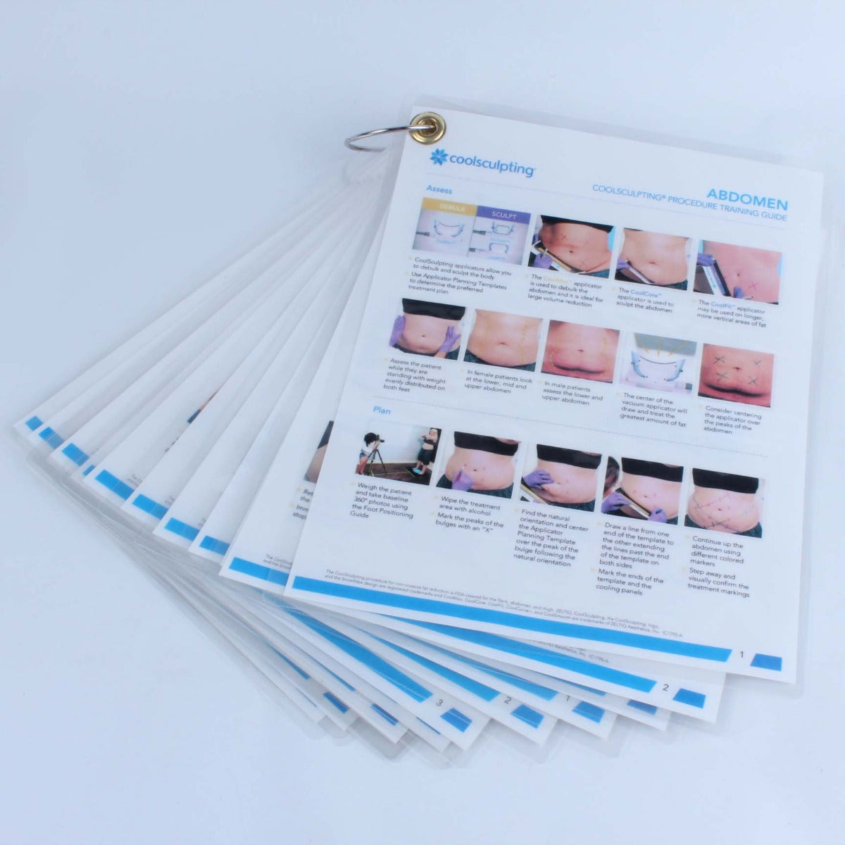 Zeltiq CoolSculpting Procedure Training Guide Abdomen Flank Inner Outer Thigh