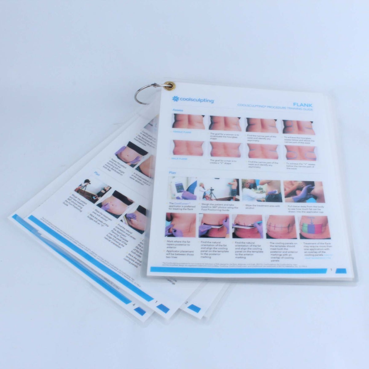 Zeltiq CoolSculpting Procedure Training Guide Abdomen Flank Inner Outer Thigh