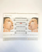 Ultherapy SPT See Plan Treat Patient Treatment Record 1010895TRN