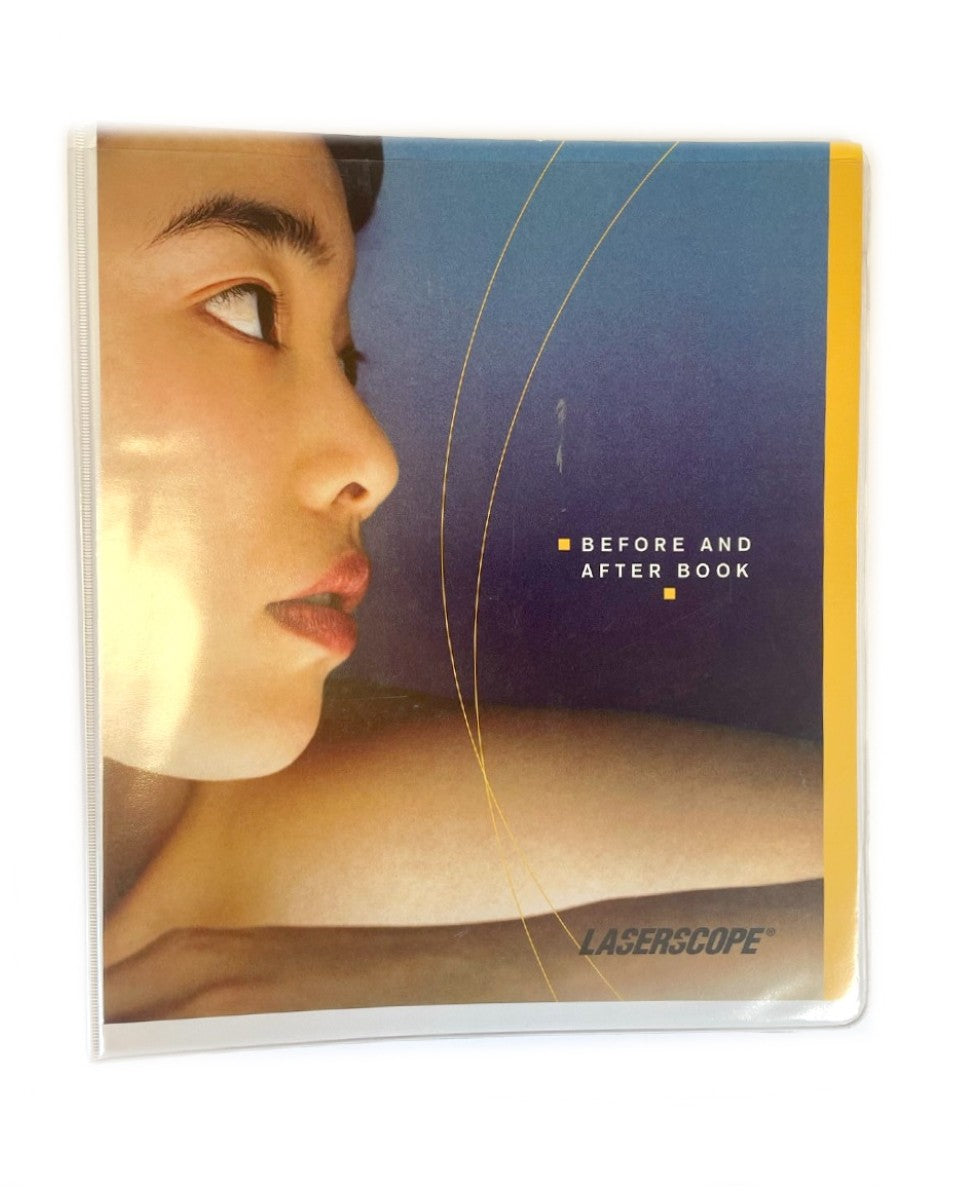 LaserScope Before and After Book Training Guide Manual