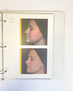 LaserScope Before and After Book Training Guide Manual